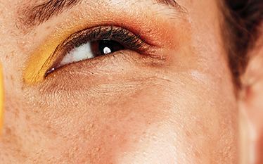 SKIN AGING