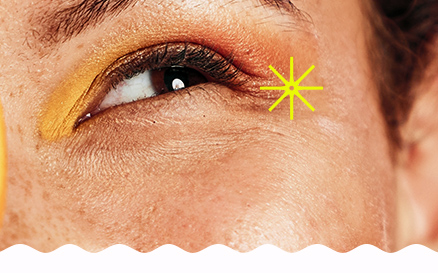 SKIN AGING