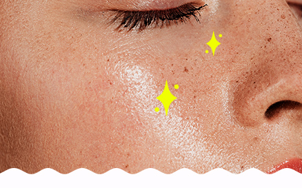OILY, SHINY SKIN