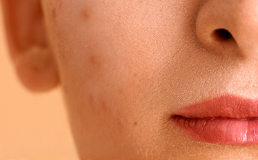 BREAKOUTS
