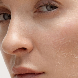 Moisturizers