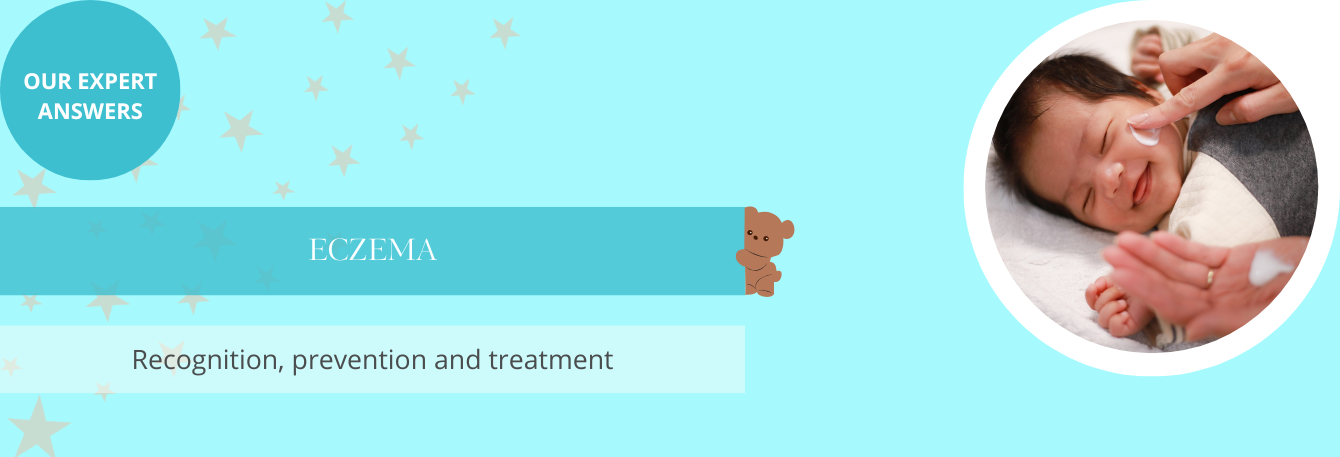 Eczema in babies: causes, symptoms, and prevention