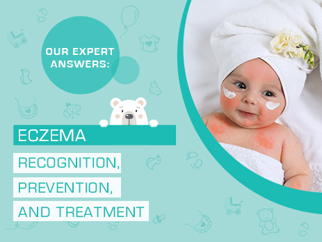 Eczema in babies: causes, symptoms, and prevention